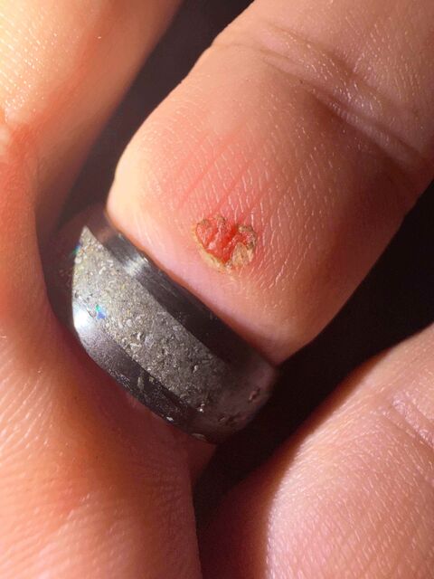 Splintered edge of the carbon fiber ring that punctured my finger Splintered Ring Edge